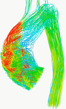 1754400855837232.gif 2_2AortaCFD_压缩.gif